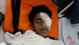হবিগঞ্জের হামলায় আহত এনসিপি নেতা আলিফের চোখে অস্ত্রোপচার, দৃষ্টিশক্তি নিয়ে শঙ্কা
